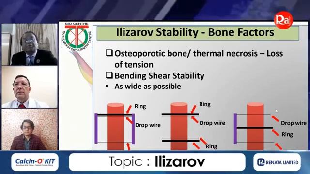 Orthopaedic Solution Academy - Prof M Bari - Ilizarov -Ep 1- Methodology past present future -Raj T смотреть онлайн