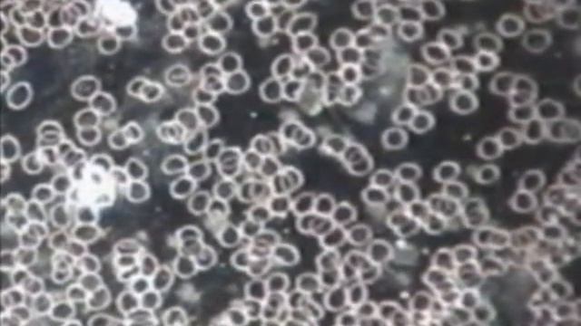 GENIE WATERWANDS MAKE MUNICIPAL WATER HEALTHY - Alkalyzes Water - Raises Ph levels смотреть онлайн