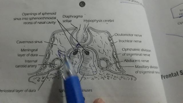 sphenoid sinus смотреть онлайн