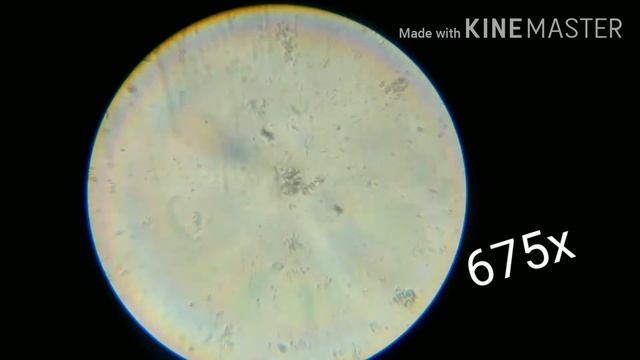 Lactobacillus (bacteria) under microscope смотреть онлайн