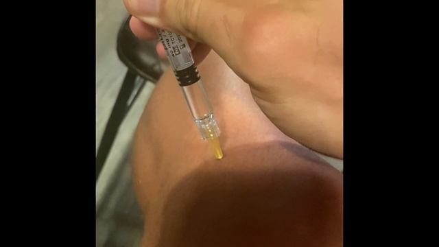 Viscosupplementation Injection To My Own Knee, Ostenil, Hyaluronic Acid.