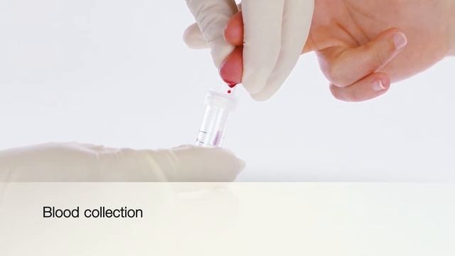New! MiniCollect K2EDTA Handling Video смотреть онлайн