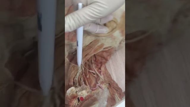 Шейное сплетение смотреть онлайн