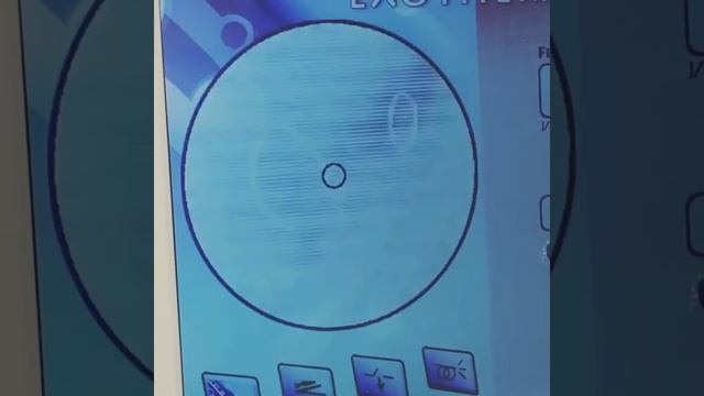 Üzde burunda sifetde bedende qollarda kapilyarlar lazerle mualice kriolazer kriosklero valikoz baki смотреть онлайн
