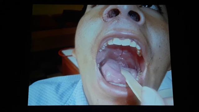 Leishmania p2 смотреть онлайн