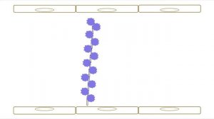 Thrombotic Thrombocytopenic Purpura (TTP) Part 1: Basics