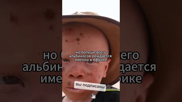 Встречали когда-нибудь альбиноса? 🤔 #факты #интересныефакты смотреть онлайн
