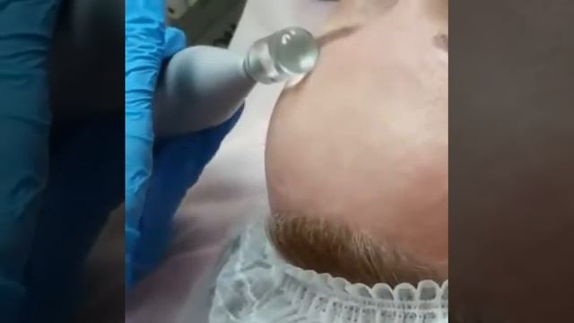 Аппаратный массаж лица. Салон АРАМИС смотреть онлайн