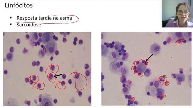 Citologia sec respiratória e exercício смотреть онлайн