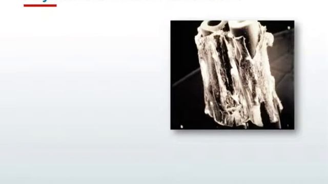 FiberCell Systems - Beyond 3-D: Recapitulating Nature for Optimal Bioproduction смотреть онлайн