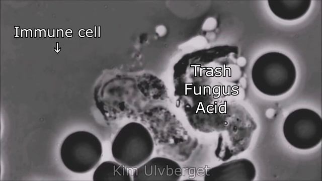 The Alkaline Balance of The Blood - The Importance of an Alkaline Lifestyle смотреть онлайн