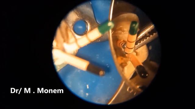 microdentistry & laser смотреть онлайн