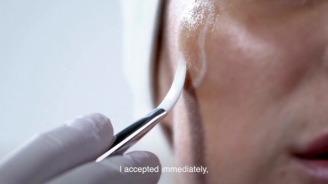 SoftFil® Cosmetics | Topilase® | Patient's Testimony смотреть онлайн