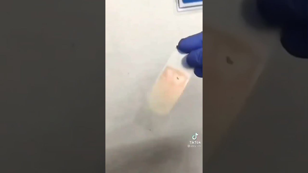 Medical platelets lymphocyte neutrophil cells смотреть онлайн