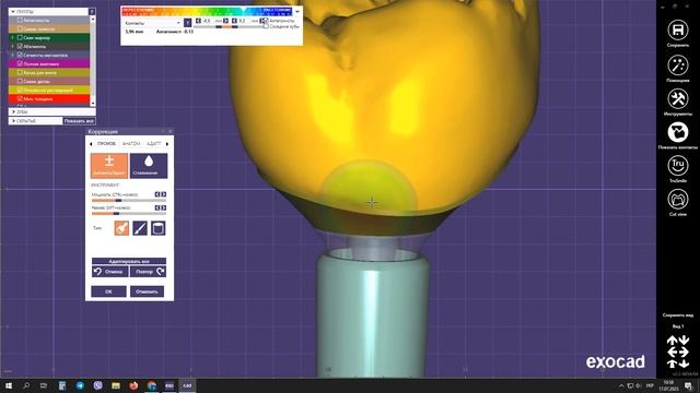 Коронка на импланте за 30 минут в Exocad. Design implant crown with scan-marker смотреть онлайн