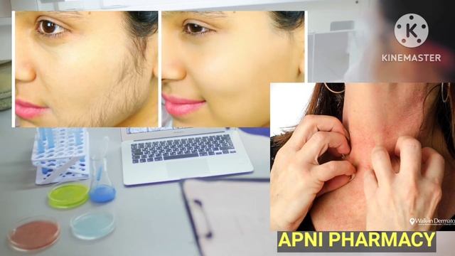 Steroid cream ke side effects ko kaise thik kare |fairness cream|Betnovate |#Betnovateside-effects смотреть онлайн