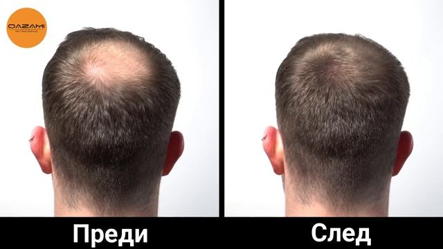 QAZAMI® Микрофибри за коса - Прикриване на плешивост смотреть онлайн