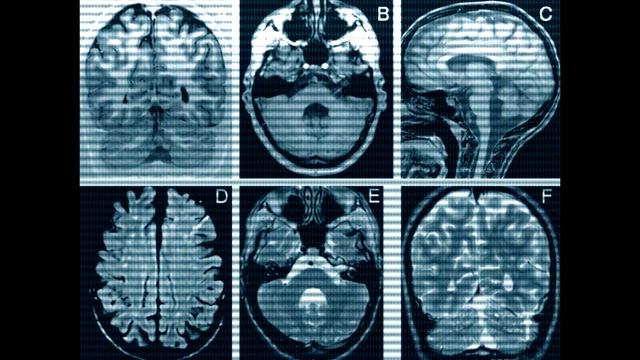 Fukutin Mutation смотреть онлайн