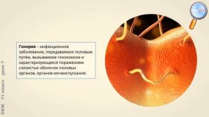 ОБЖ 11 класс Урок№7   Инфекции, передаваемые половым путем  Меры их профилактики  720p