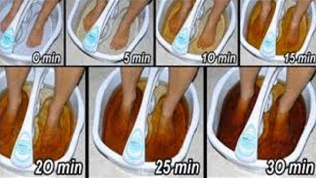 FOOT DETOX: HOW TO FLUSH TOXINS FROM YOUR BODY THROUGH YOUR FEET смотреть онлайн