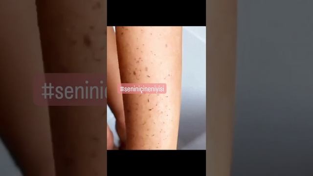 Cildin nefes alırsa mutlu da olursun belki hayallerin bile gerçekleşir ... смотреть онлайн