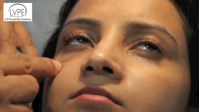 Under Eye Fillers смотреть онлайн