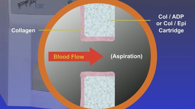 The Platelet Function Analyzer PFA-100® System смотреть онлайн