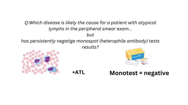 Infectious mono, atypical lymph’s, EBV, lab смотреть онлайн