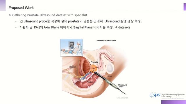Measurement Of Prostate Size With Ultrasound In Deep Learning