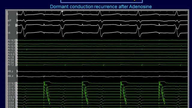 EP 101, Online EP Learning, Heart Rhythm Learning Series