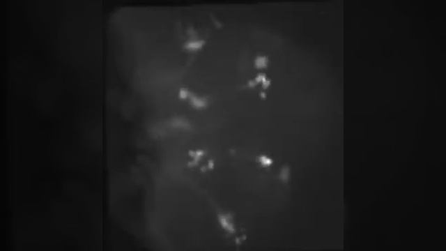 Dopamine neurons observed with LFM смотреть онлайн