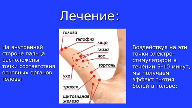 Как снять головную боль 24 04 24 смотреть онлайн