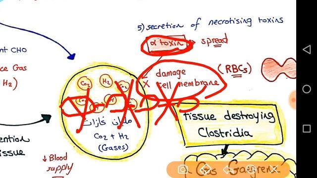 Clostridium Perfringens | Dr Amr Abdallah смотреть онлайн