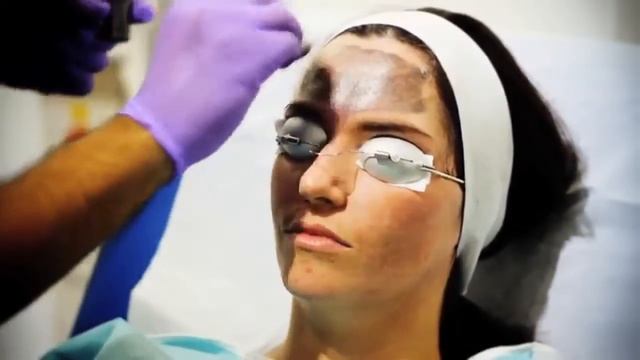 Dr. Tapan Patel, Lutronic Spectra Peel Demo смотреть онлайн
