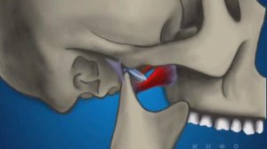 ВНЧС. Сустав верхнечелюстной.