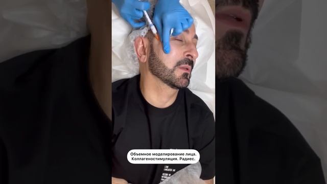 Препарат Radiesse – это препарат выбора и для мужчин смотреть онлайн