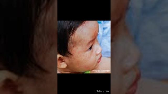 #India receives ‘#Measles and #Rubella Champion’ Award for Measles and Rubella Disease Prevention смотреть онлайн