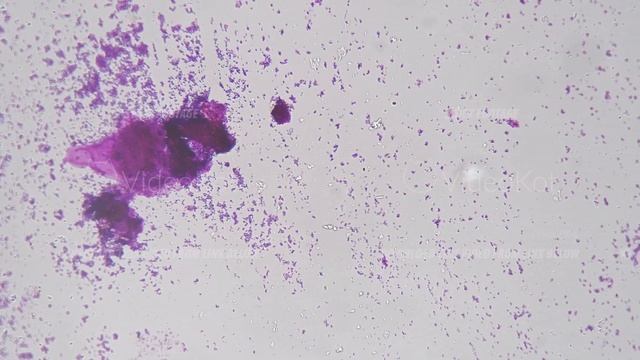 Three types of bacteria are filmed under microscope against bright field in static condition 200x смотреть онлайн