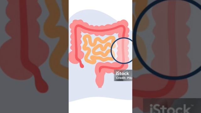 Function and structure of small intestine.. смотреть онлайн