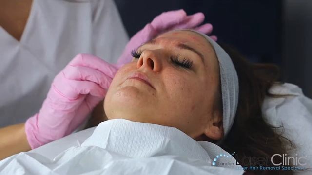 Anti-wrinkle injections on forehead and crows feet. смотреть онлайн