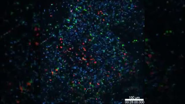 Spatiotemporal Basis of Innate and Adaptive Immunity in Secondary Lymphoid Tissue: Video 17 смотреть онлайн