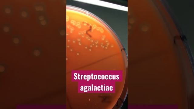 Streptococcus agalactiae - рост стрептококка с гемолизом на кровяном агаре смотреть онлайн