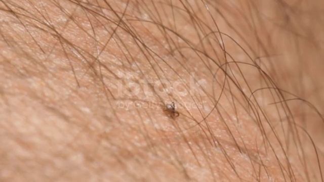 Қандаладан құтылғыңыз келсе😱 тез көріңіз 🥺💯 смотреть онлайн