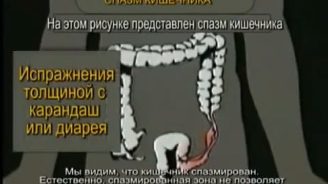 Наш желудок - наша жизнь. смотреть онлайн