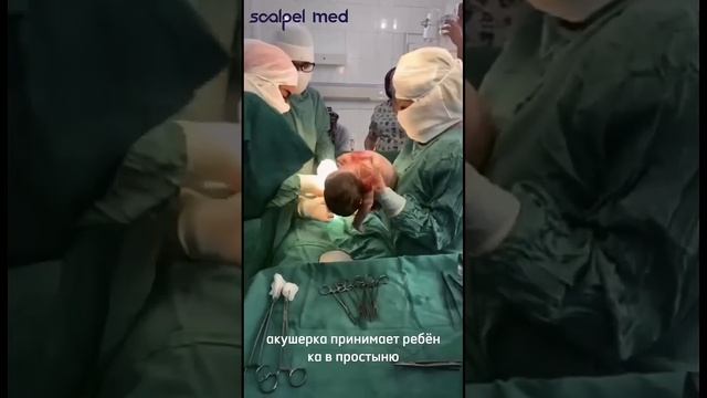 КАК ПРОХОДЯТ РОДЫ|SCALPEL.MED смотреть онлайн