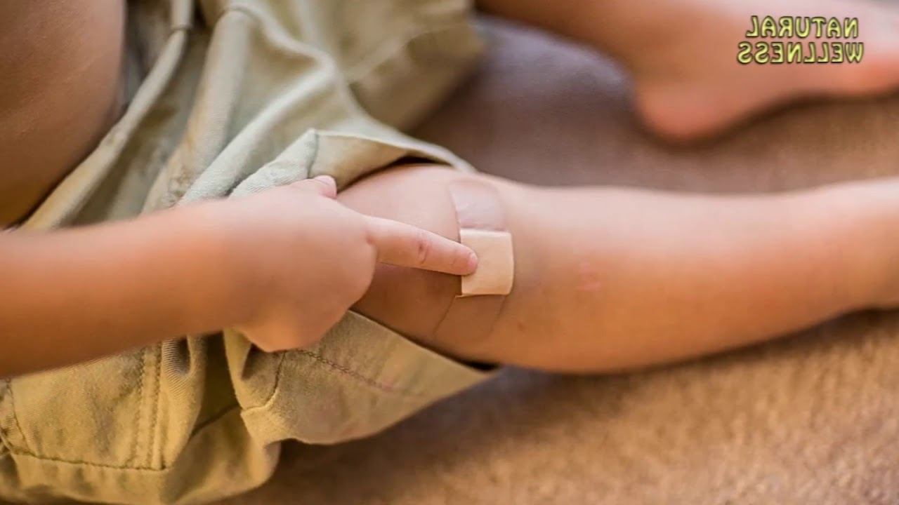 Bakteri merugikan!! "Klebsiella pneumoniae" смотреть онлайн