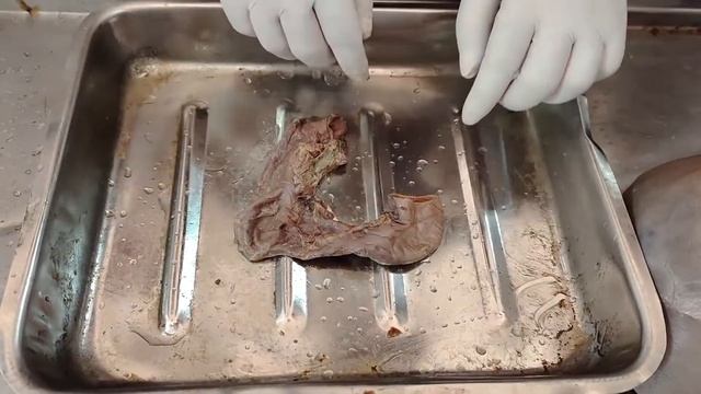 Anatomy of duodenum, Introduction, shape, size, location, parts etc. #duodenum #grossanatomy смотреть онлайн