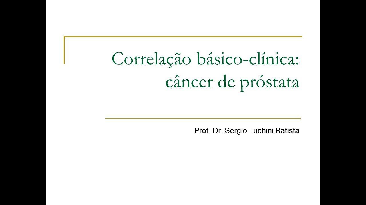 VideoAula 3 Sistema urogenital _ Câncer de próstata смотреть онлайн
