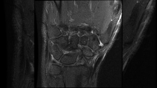 UPPER EXTREMITY JOINT W O CON RIGHT 4 смотреть онлайн