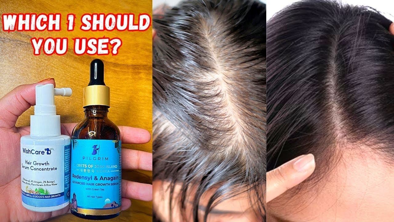 Pilgrim Vs Wishcare Hair Growth Serum | Pilgrim hair growth serum | Wishcare hair growth serum смотреть онлайн